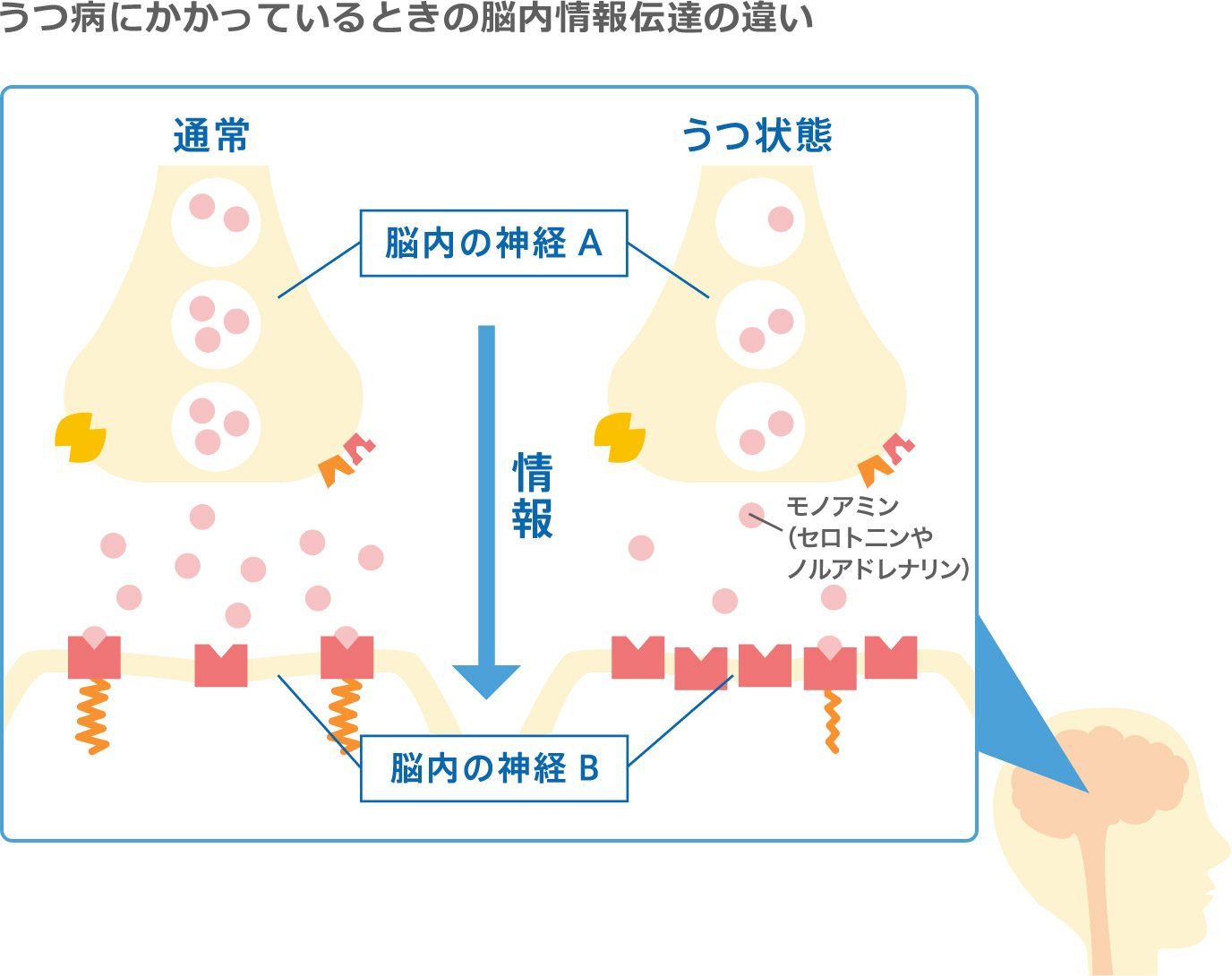 うつ病にかかっているときの脳内情報伝達の違い