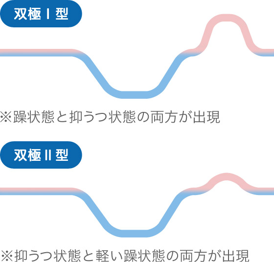 双極性うつ病