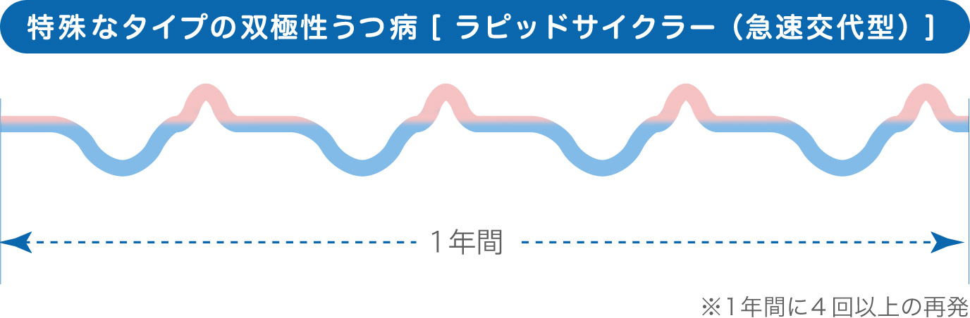 特殊なタイプの双極性うつ病