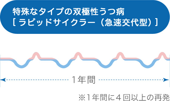 特殊なタイプの双極性うつ病